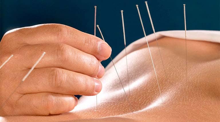 Khoá học châm cứu bấm huyệt vào thứ 7 và chủ nhật