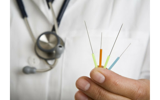 Học châm cứu là học những gì?