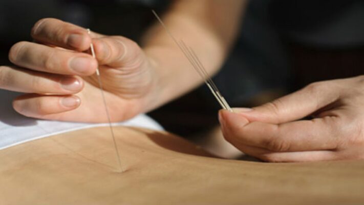 Bàn về việc học châm cứu online?