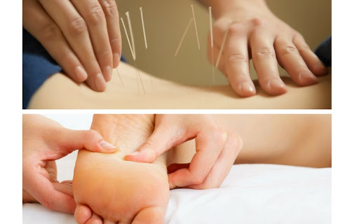 Mức lương của nghề châm cứu bấm huyệt?