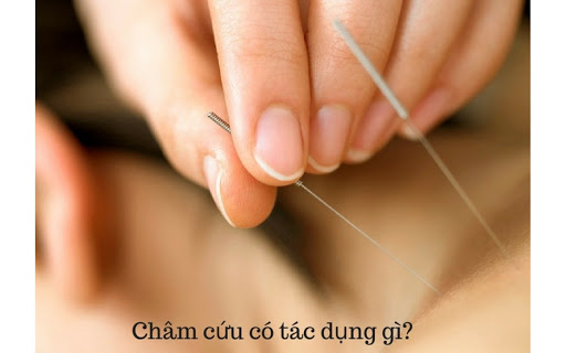 Tại sao lại cần chứng chỉ hành nghề châm cứu bấm huyệt?