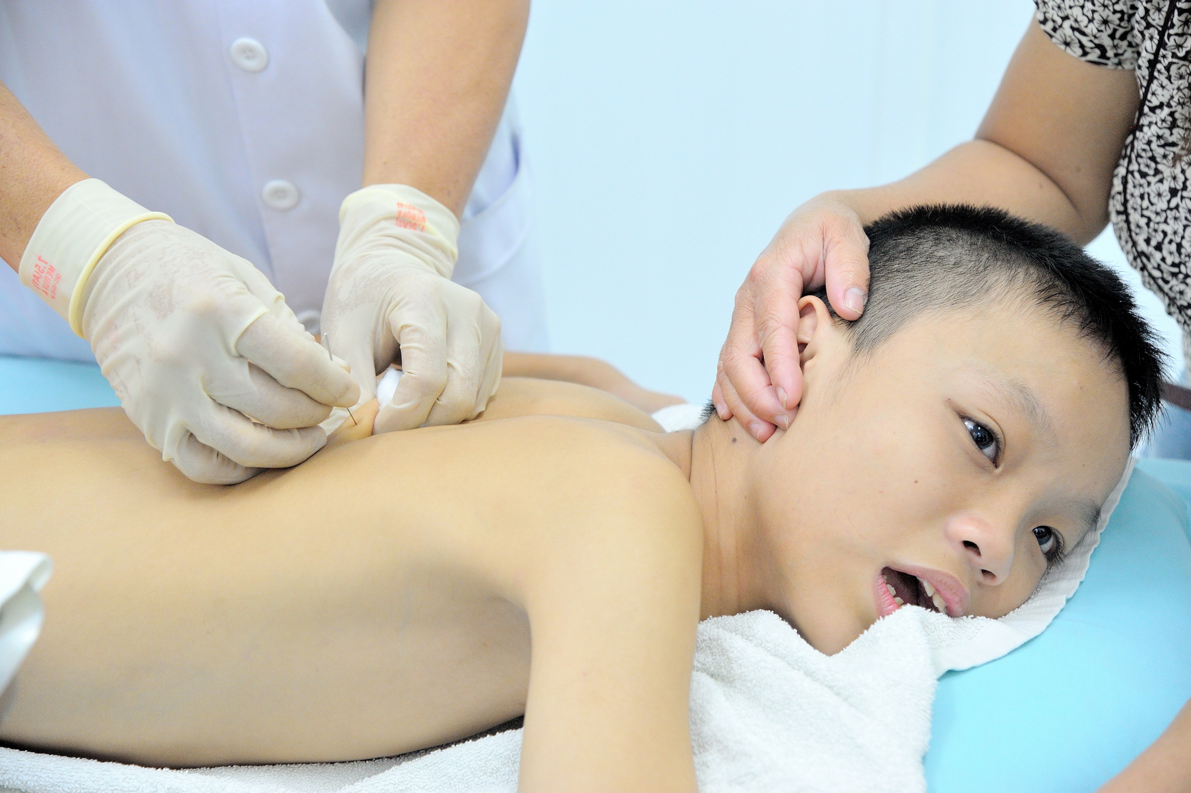 Tự học châm cứu có nguy hiểm không?