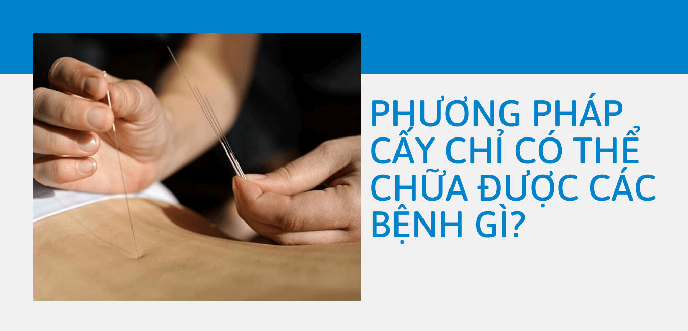 phương pháp cấy chỉ chữa bệnh gì